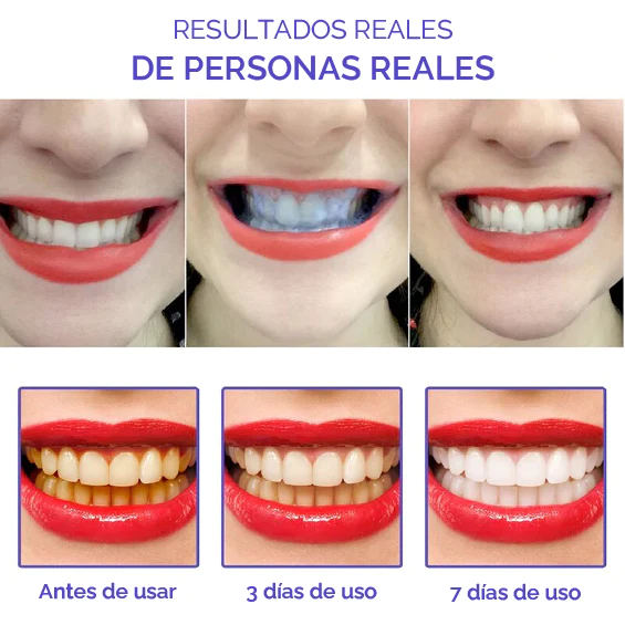Kit Smile Kit: Blanqueador + Spray bucal T