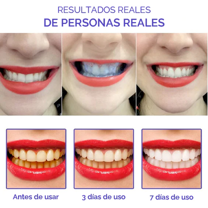 Kit Smile Kit: Blanqueador + Spray bucal T