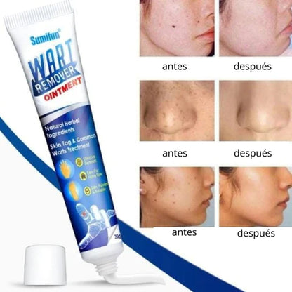 Pack de 2 cremas removedor de verrugas