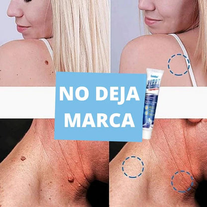 Pack de 2 cremas removedor de verrugas